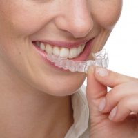 invisalign thailand